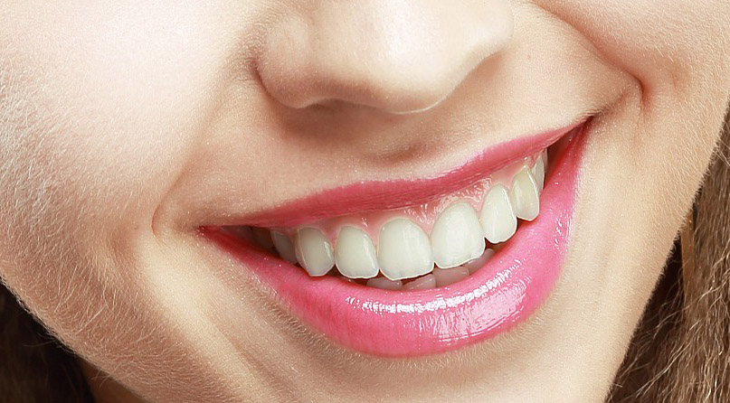 estética dental Santa Coloma de Gramenet