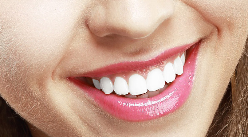 estética dental Santa Coloma de Gramenet