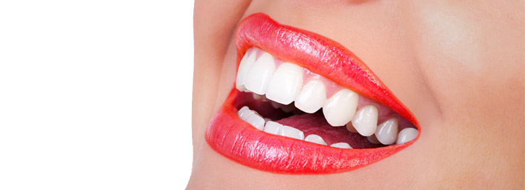 estética dental Santa Coloma de Gramenet