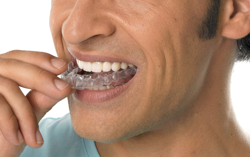 ortodoncia invisalign santa coloma