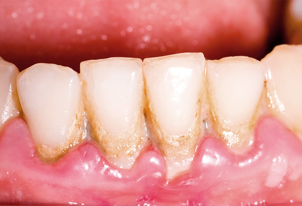 periodoncia Santa Coloma de Gramenet