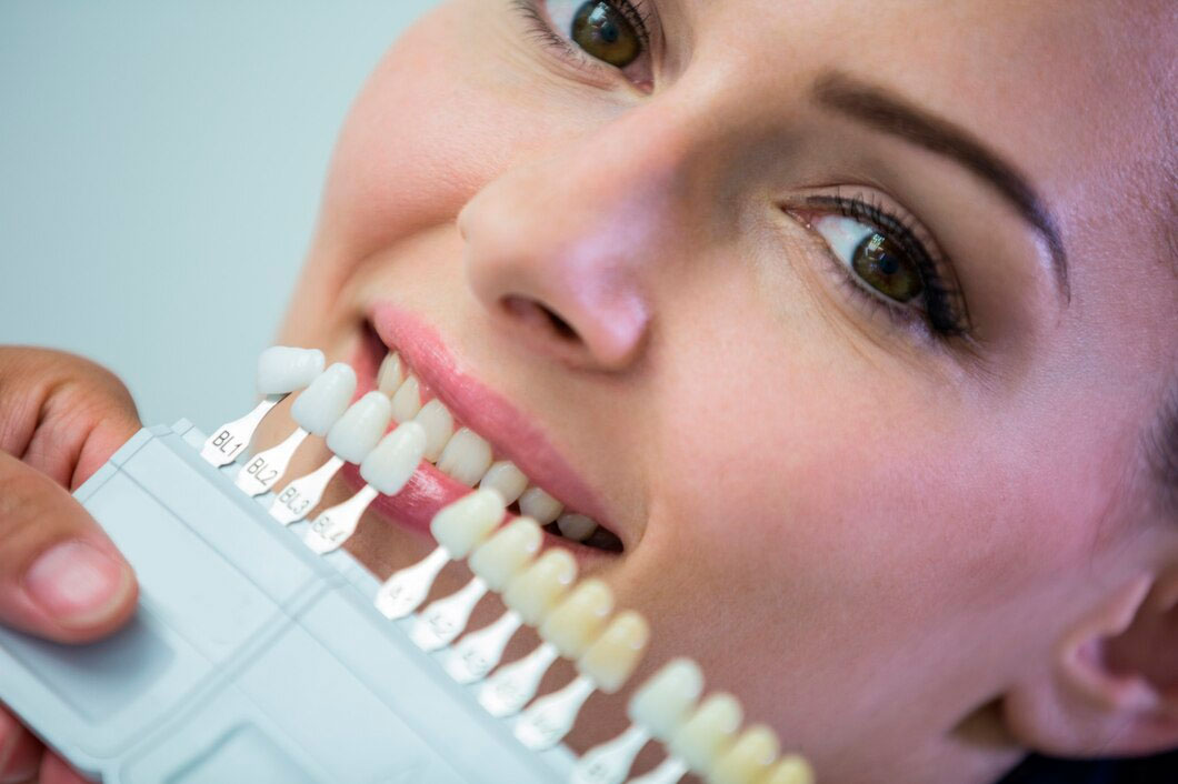 Clínica dental Aldana tratamiento de carillas dentales