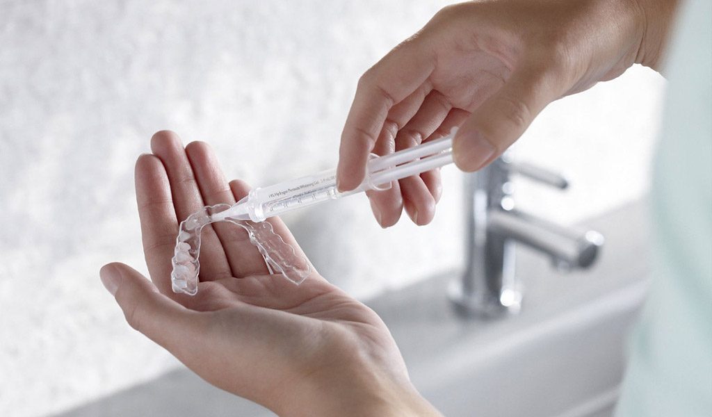 blanqueamiento dental en Santa Coloma de Gramenet