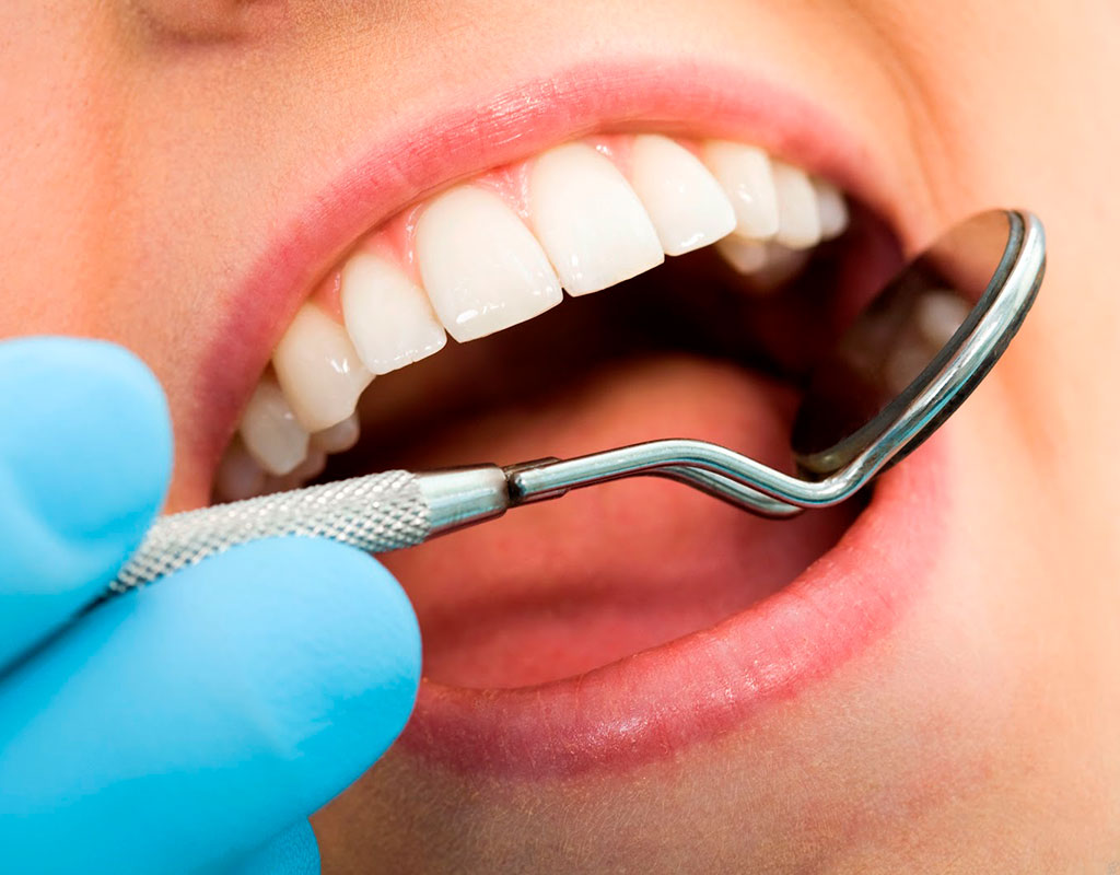 caries y endodoncia en Santa Coloma de Gramenet