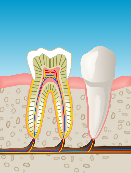 endodoncia en Santa Coloma de Gramenet