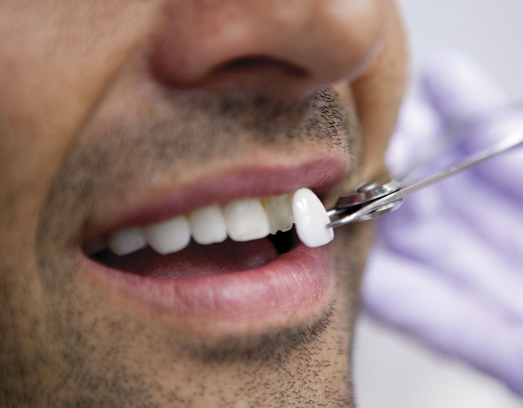 estética dental en Santa Coloma de Gramenet