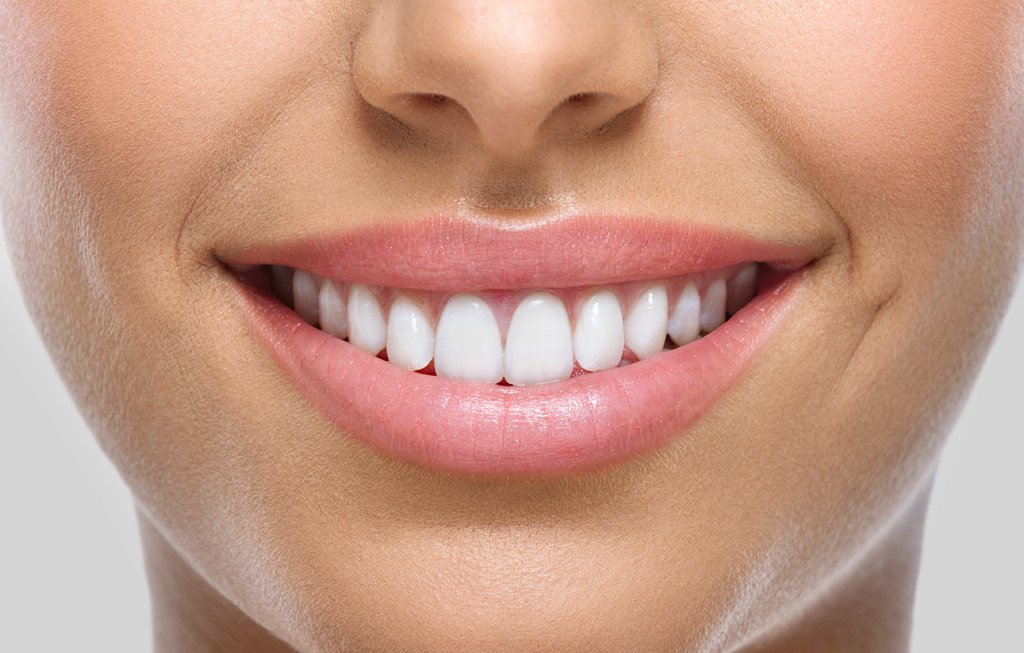 estética dental en Santa Coloma de Gramenet
