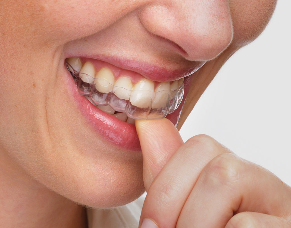 estética dental en Santa Coloma de Gramenet