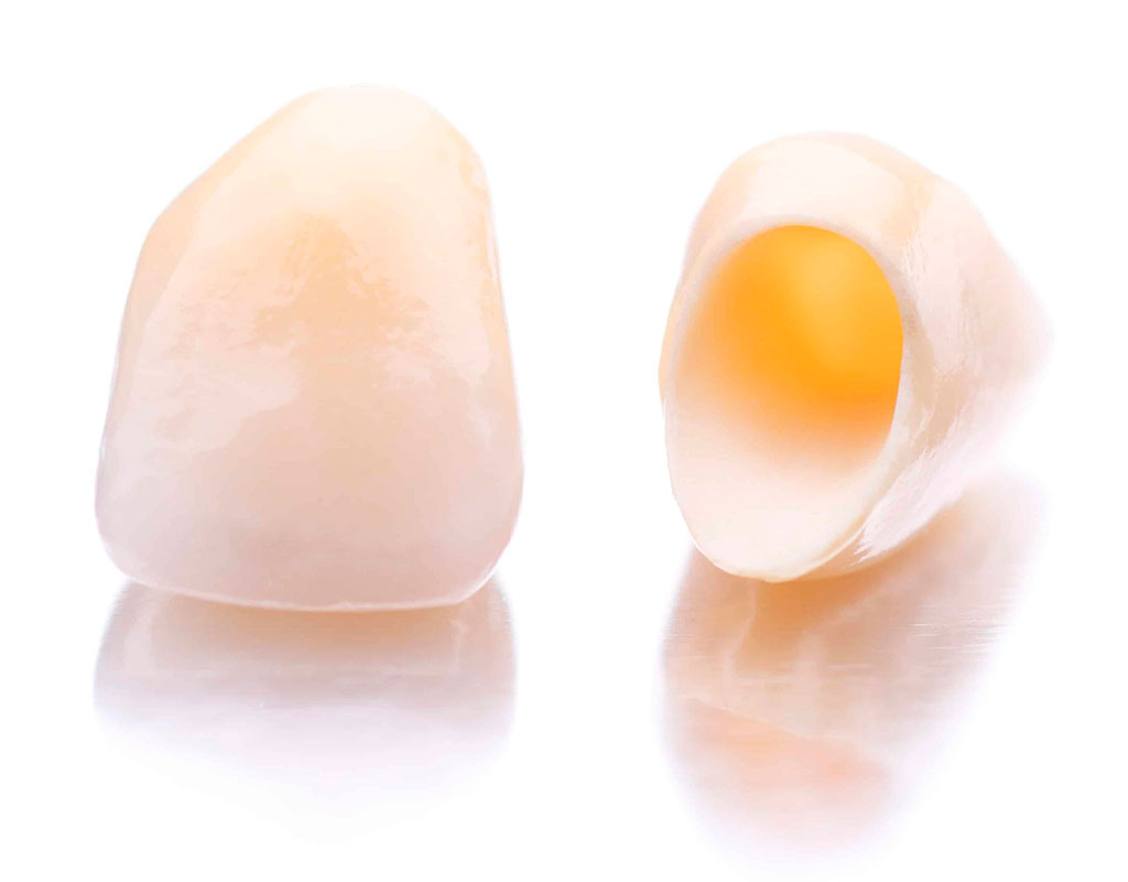 estética dental en Santa Coloma de Gramenet