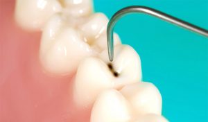 higiene dental en Santa Coloma de Gramenet