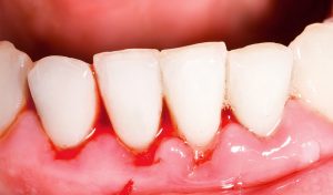 higiene dental en Santa Coloma de Gramenet