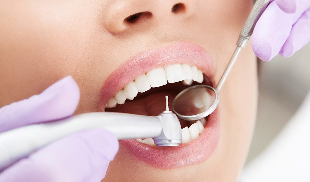 higiene dental en Santa Coloma de Gramenet