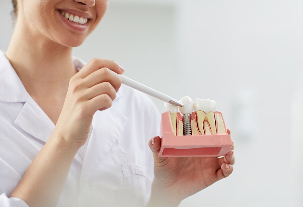 Implantes dentales de carga inmediata en Santa Coloma de Gramenet