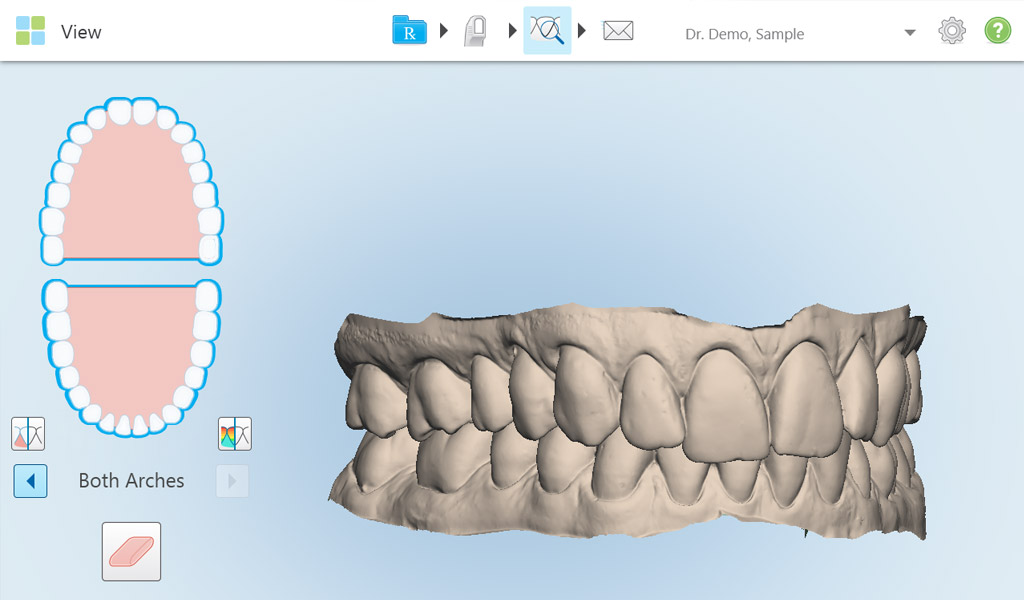 Ortodoncia Invisalign en Santa Coloma de Gramenet