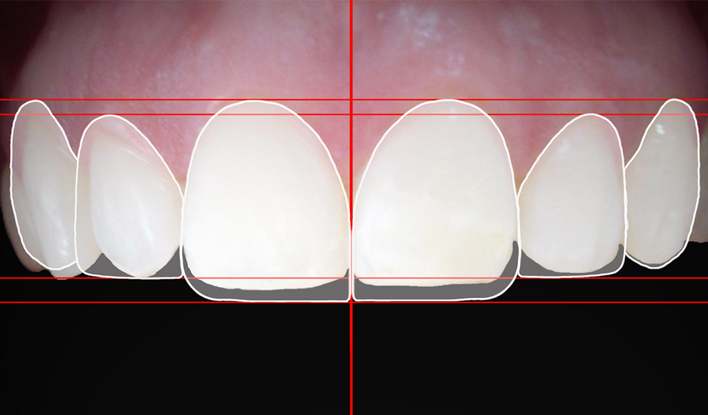estética dental en Santa Coloma de Gramenet