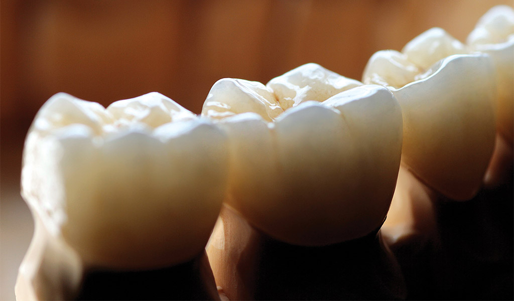 estética dental en Santa Coloma de Gramenet